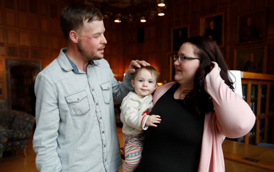  Lilly Ross holds her 17-month-old son Leonard as she talks with face transplant recipient Andy Sandness