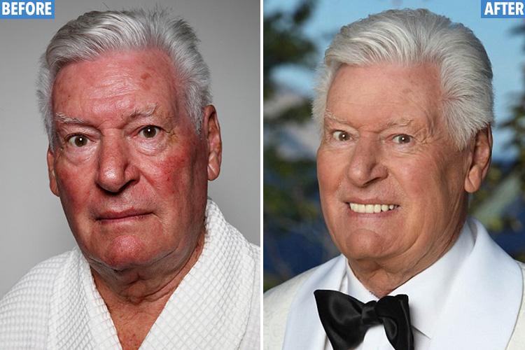  Roy Walker's accident affected his result but still saw his brain age drop from 73 to 59