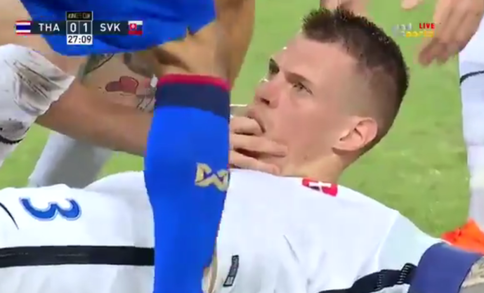  Team-mate Ondrej Duda potentially saved Skrtel's life with his quick thinking