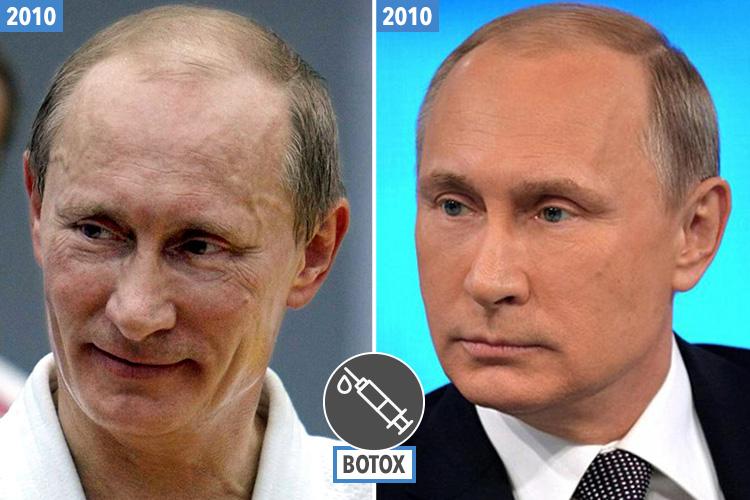 A very wrinkly looking Putin pictured after a judo session back in 2010 (left). But months EARLIER, Putin looked bronzed and wrinkle-free (right). Dr Lambe says this is down to "some quite successful Botox work"