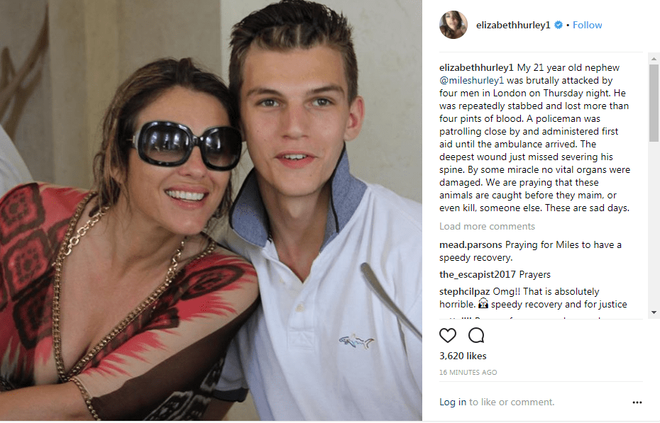  Taking to Instagram, Liz Hurley said her nephew almost had his spine severed in the brutal attack