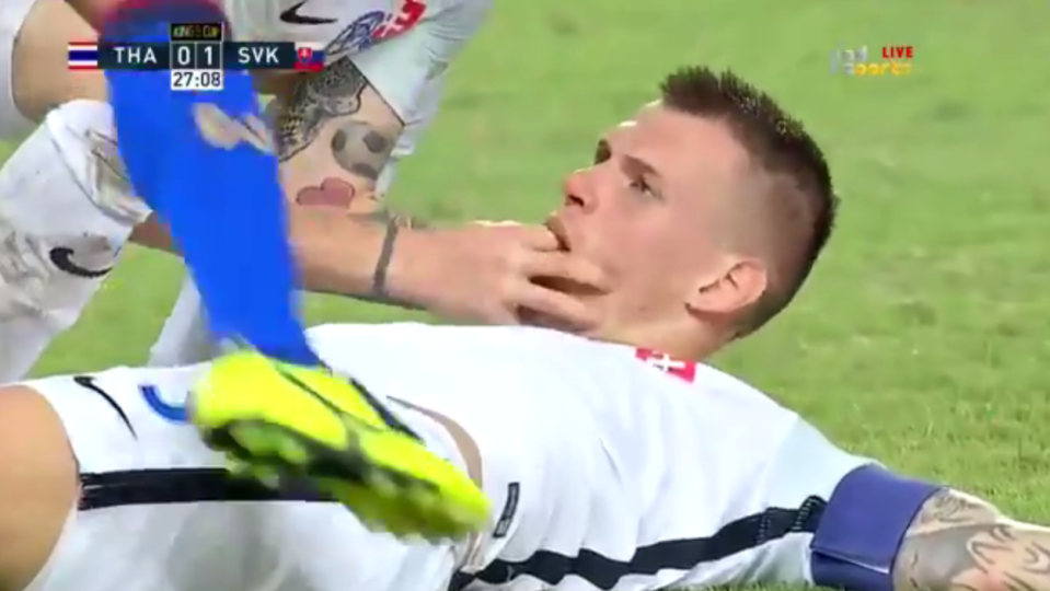  Martin Skrtel reportedly swallowed his tongue in Slovakia's win over Thailand