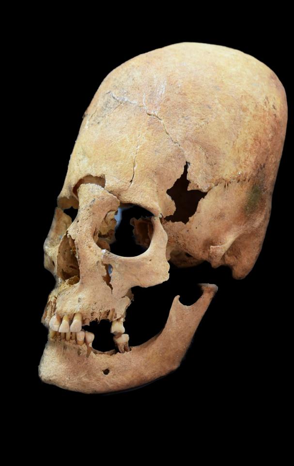  This is one of the 'cone-shaped' skulls found in south Eastern Europe