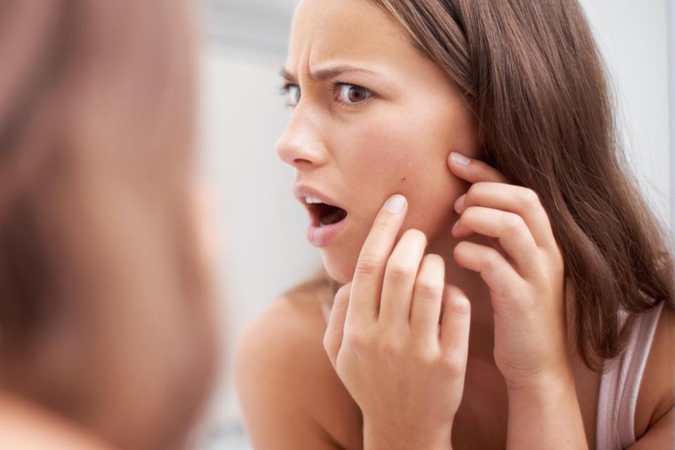  People who suffer from acne may find their symptoms get worse when the clocks go forward