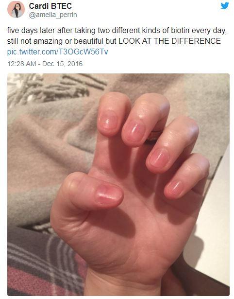 Amelia thanked biotin for the recovery of her nails