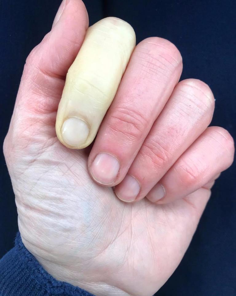  The 42-year-old shared this picture on her Instagram to show what happens to her hands