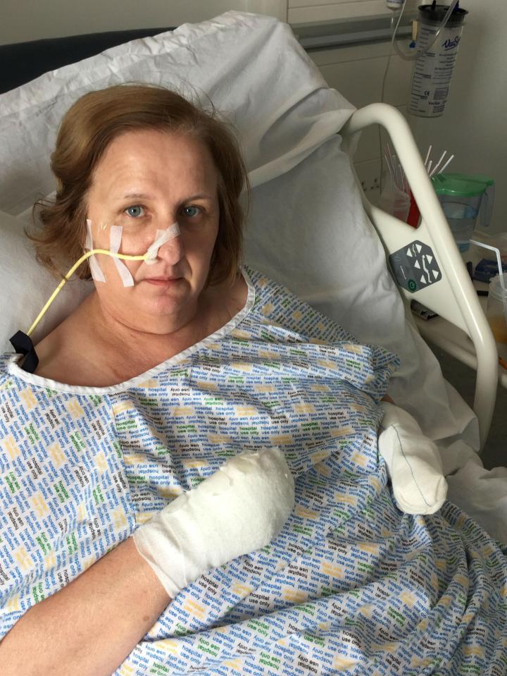 The gran is now facing losing all her limbs after developing sepsis