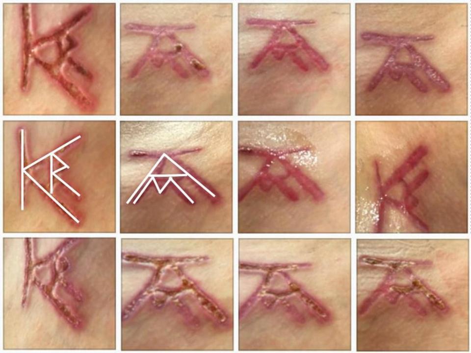  NXIVM's founder Keith Raniere's initials were allegedly burnt into the flesh of members, as well as Allison Mack's