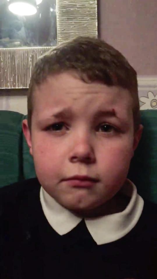  Red-faced schoolboy Billy-Joe Cain tearfully asked his mum to draw on eyebrows after he shaved them off