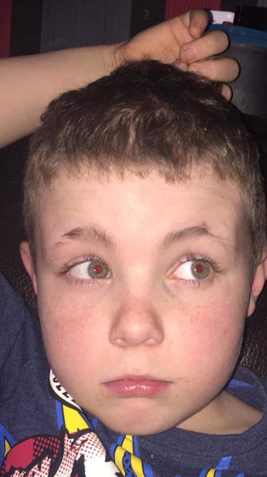  The youngster managed to shave off half of each eyebrow