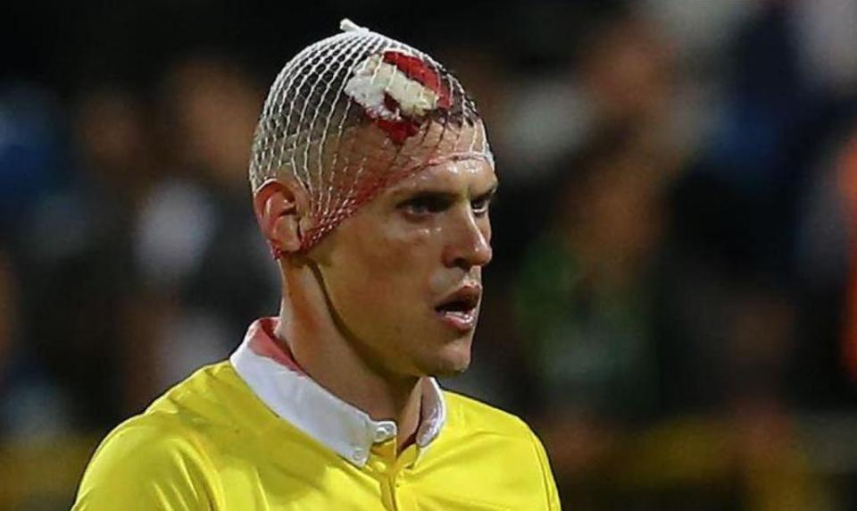 Martin Skrtel suffered a horror head wound playing for Fenerbahce this weekend - but refused to be substituted