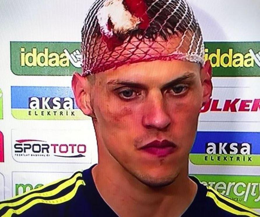 Incredibly the Slovak hardman appeared unflustered despite suffering the bad head injury