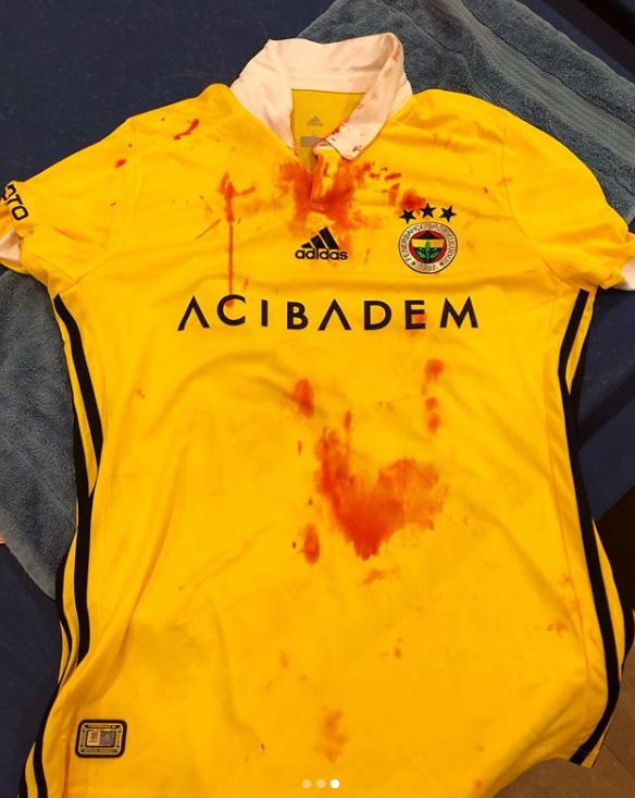 The former Liverpool defender uploaded a photo of his blood-spattered shirt following the game to remember