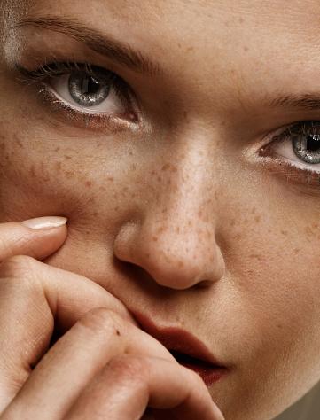  The average Brit has around 35 freckles across their body