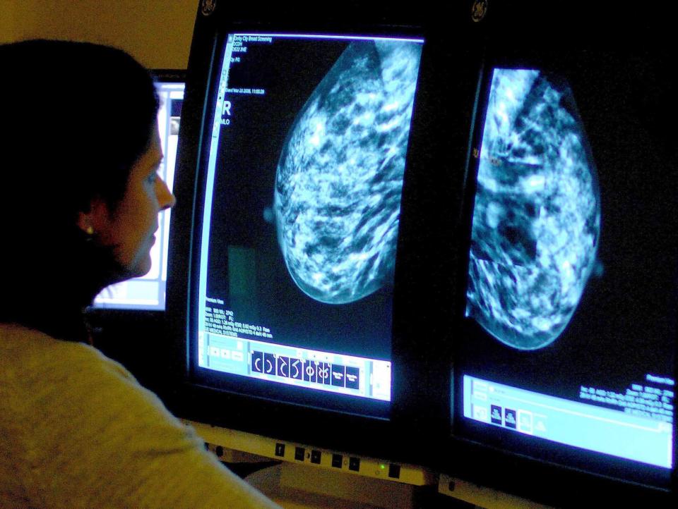 Between 130 and 270 women could have lost their lives to breast cancer as a result of the IT glitch