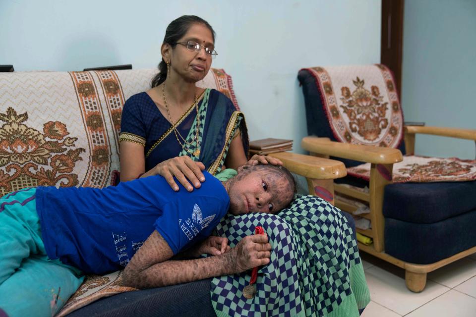 Vedika's mum, Madhuri Gupta, is hoping to raise money to find a treatment for her children