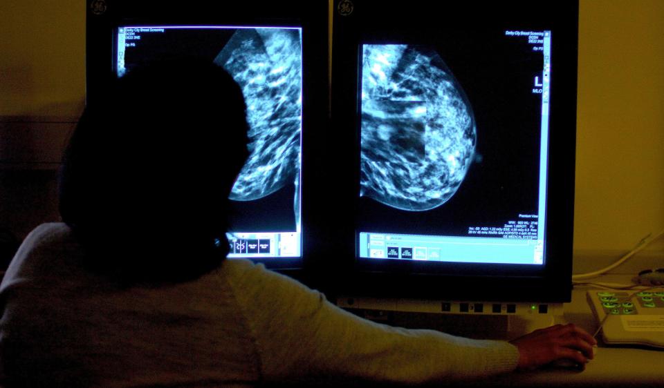  With the breast cancer screening scandal we are reminded of the human cost of these failures