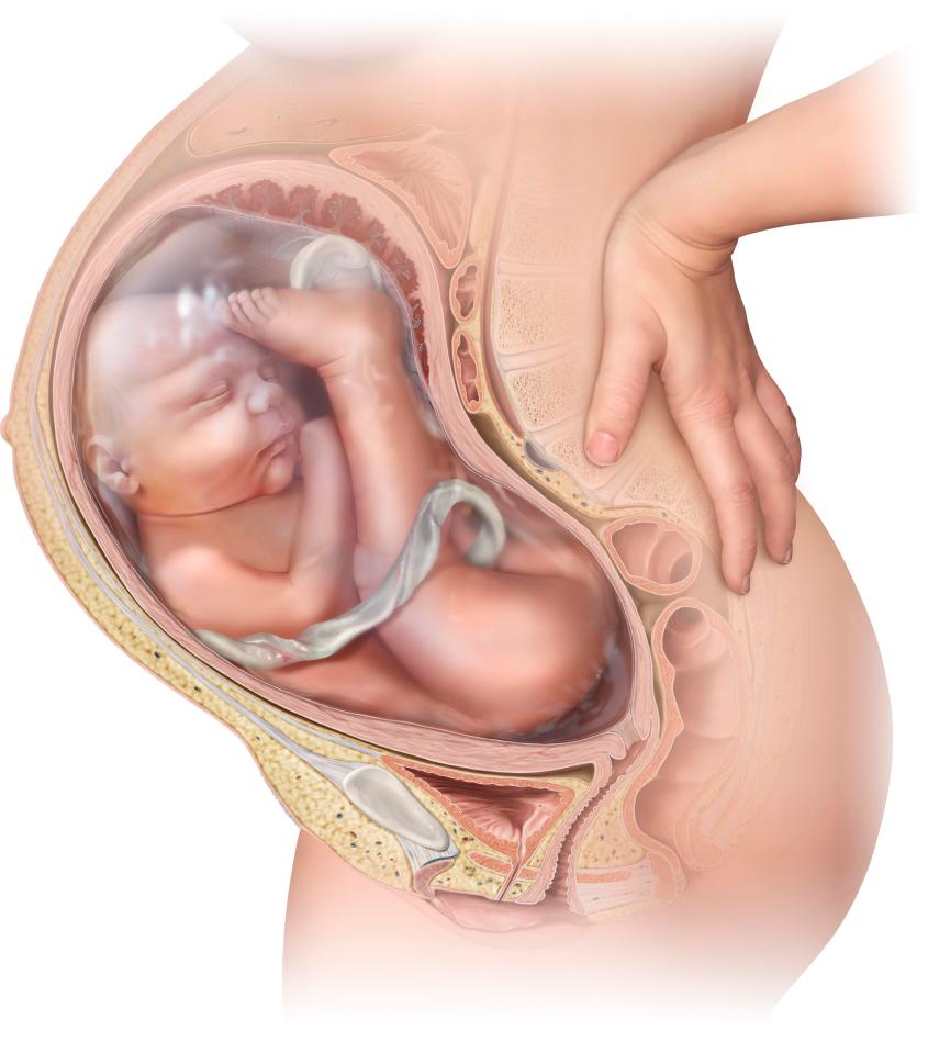  A breech birth occurs when the baby hasn't moved around to come out head first