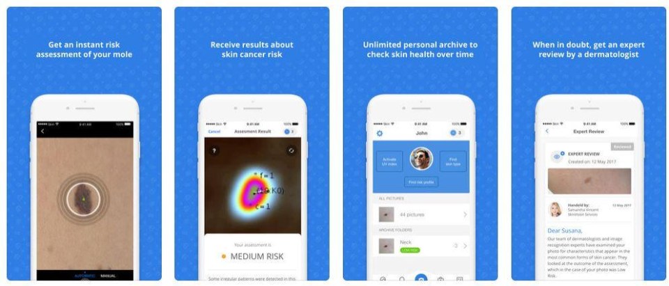 The app Skin Vision helps track moles, to spot for deadly changes
