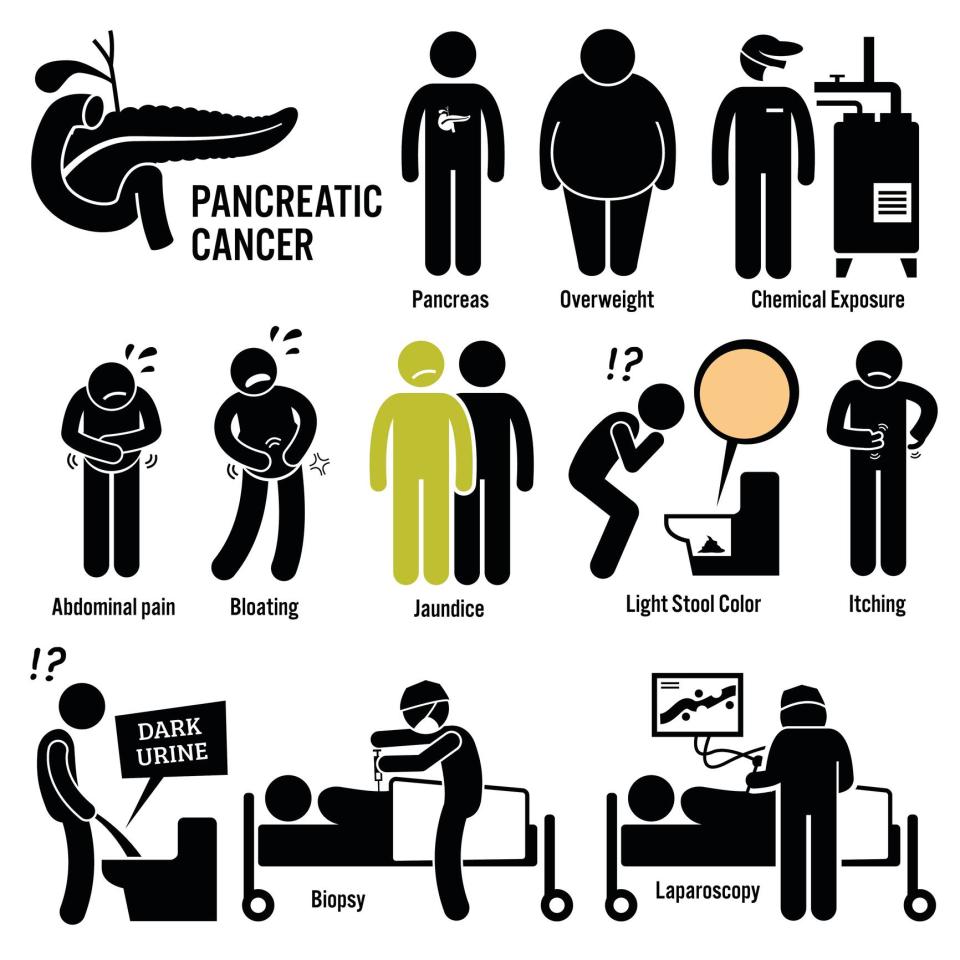  Set of illustrations for pancreatic disease which include the causes, symptoms and diagnosis