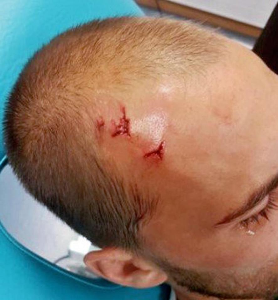 Striker Bas Dost needed stitched following attack at Sporting training camp