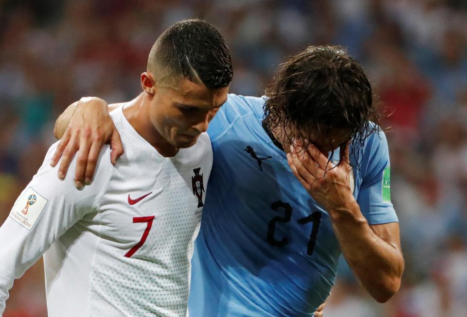 Edinson Cavani looked devastated as he finished his night injured