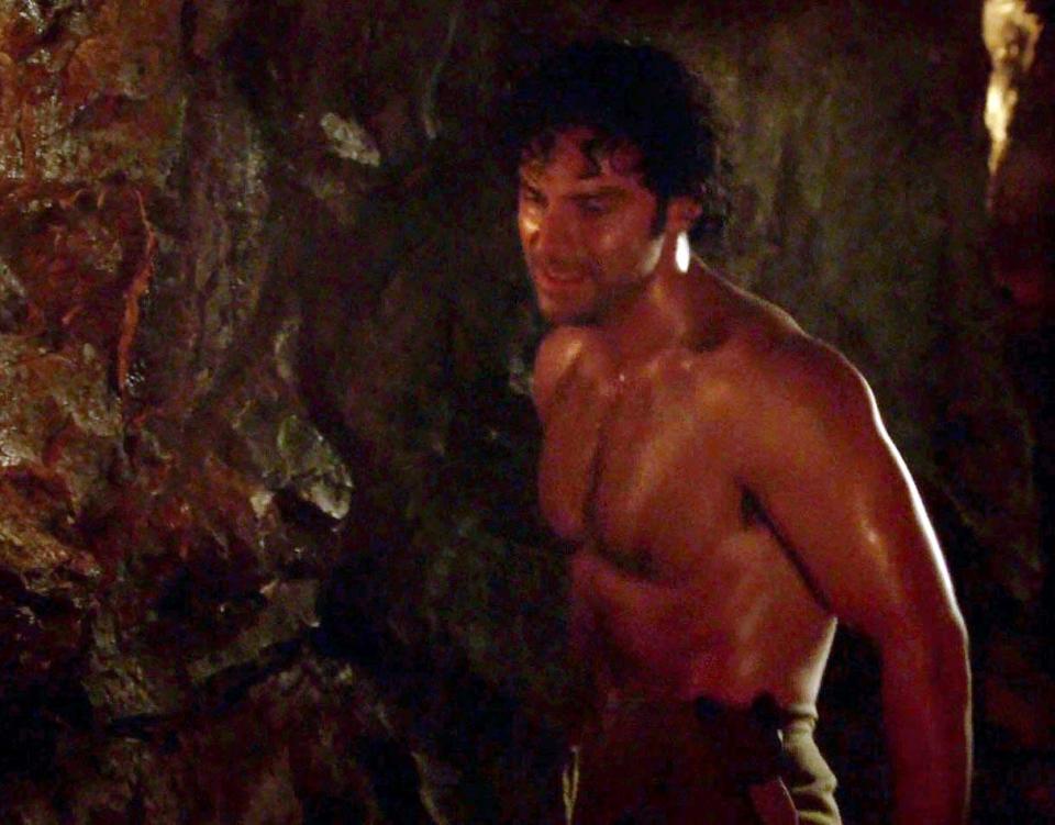  The hunk is famed for going shirtless on Poldark