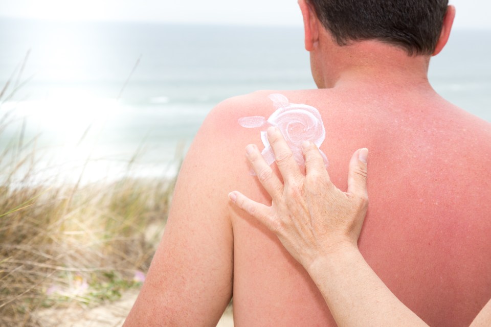  Sunburn can be uncomfortable and as temperatures rise this weekend, it's key to make sure you're well protected