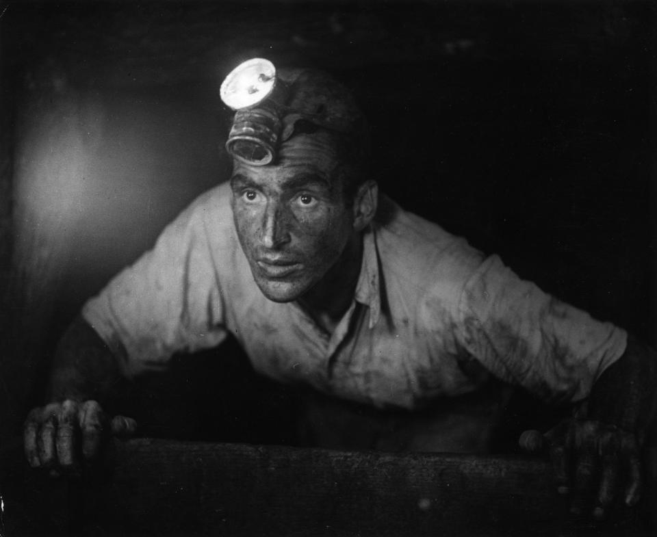 In the mines alone, there were one million injuries per year. And we are not talking about people cutting themselves on a piece of rock, they were very serious injuries 