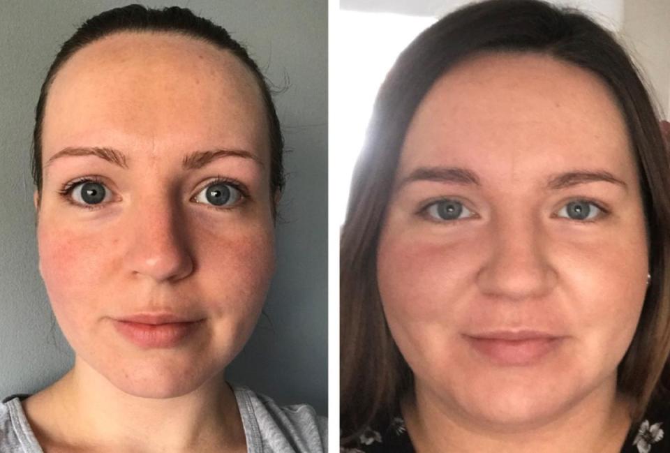 Janine's incredible weight loss is visible in her face