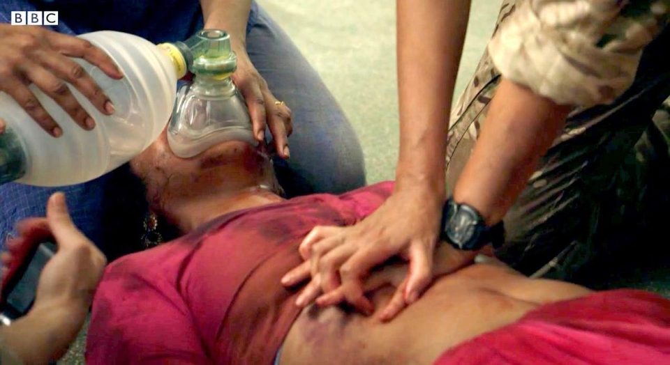  Michelle Keegan's CPR technique has drew criticism after pressing on her co-star's stomach