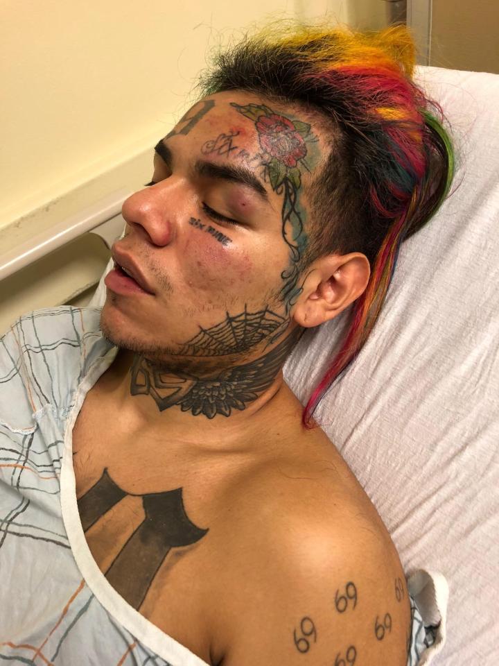  Tekashi 6ix9ine was rushed to hospital after the savage beating