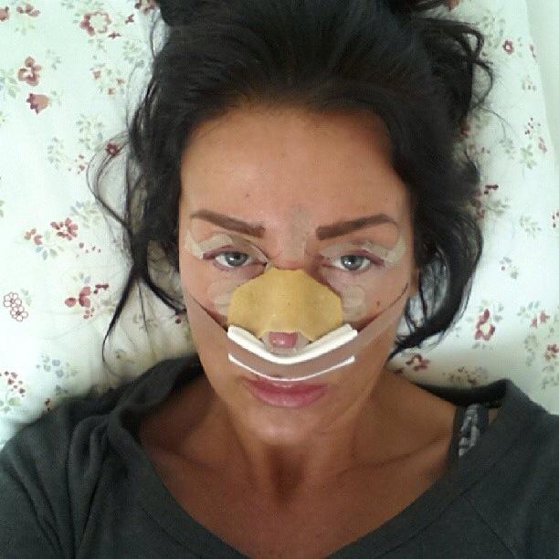  Aimi had a nose job in Romania which cost £3,500 as she had her eye lids done at the same time