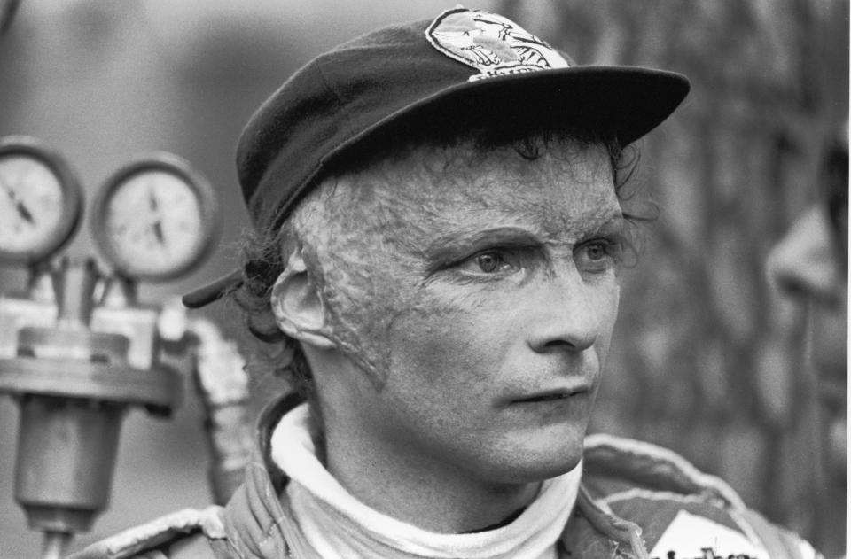 Lauda returned to racing despite being left severely injured in a fireball crash at the German Grand Prix in 1976