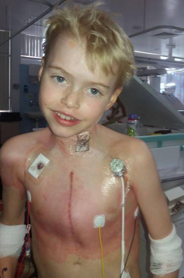  Max Johnson's life was saved after he received a heart transplant