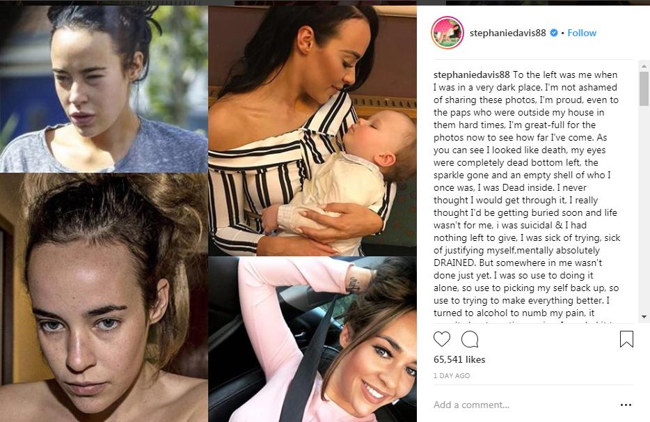 Stephanie Davis has posted this emotional message with pictures showing how far she has come since her ‘dark time’