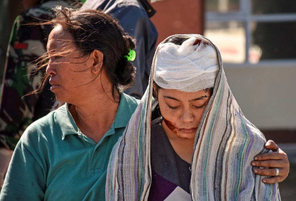  A wounded woman walks outside the North Lombok Hospital after the quake