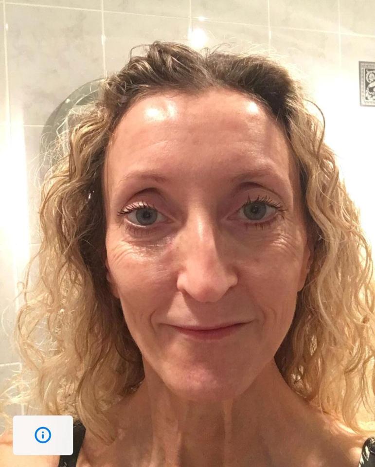  After having a chemical peel, the gran-of-two's skin looks rejuvenated