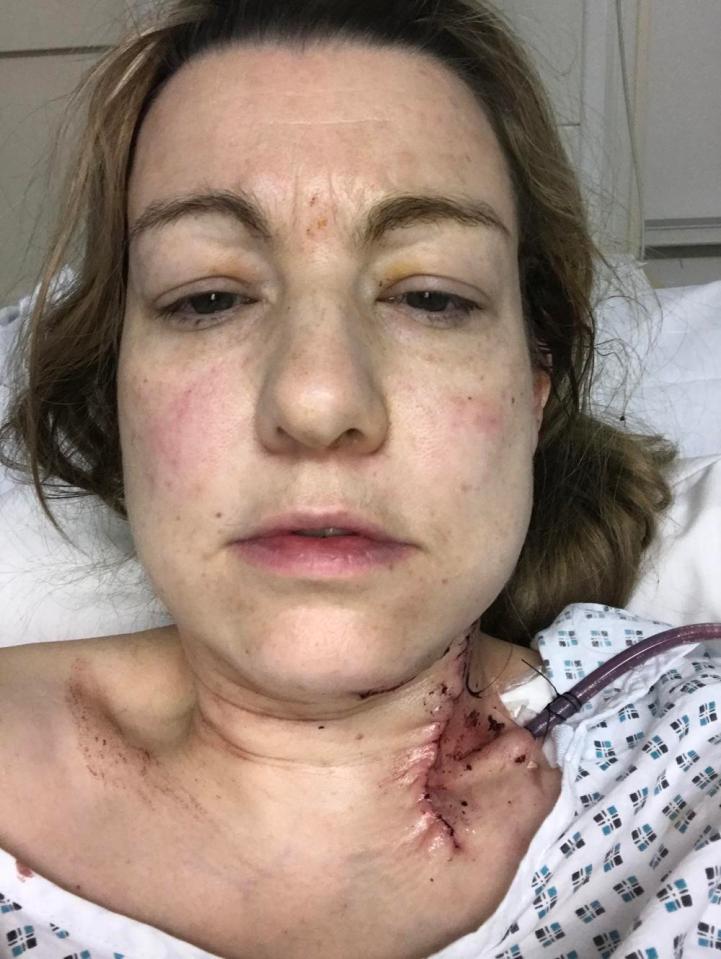  Her son Morgan described her bleeding ear as 'minging' - but it was the start of something more sinister