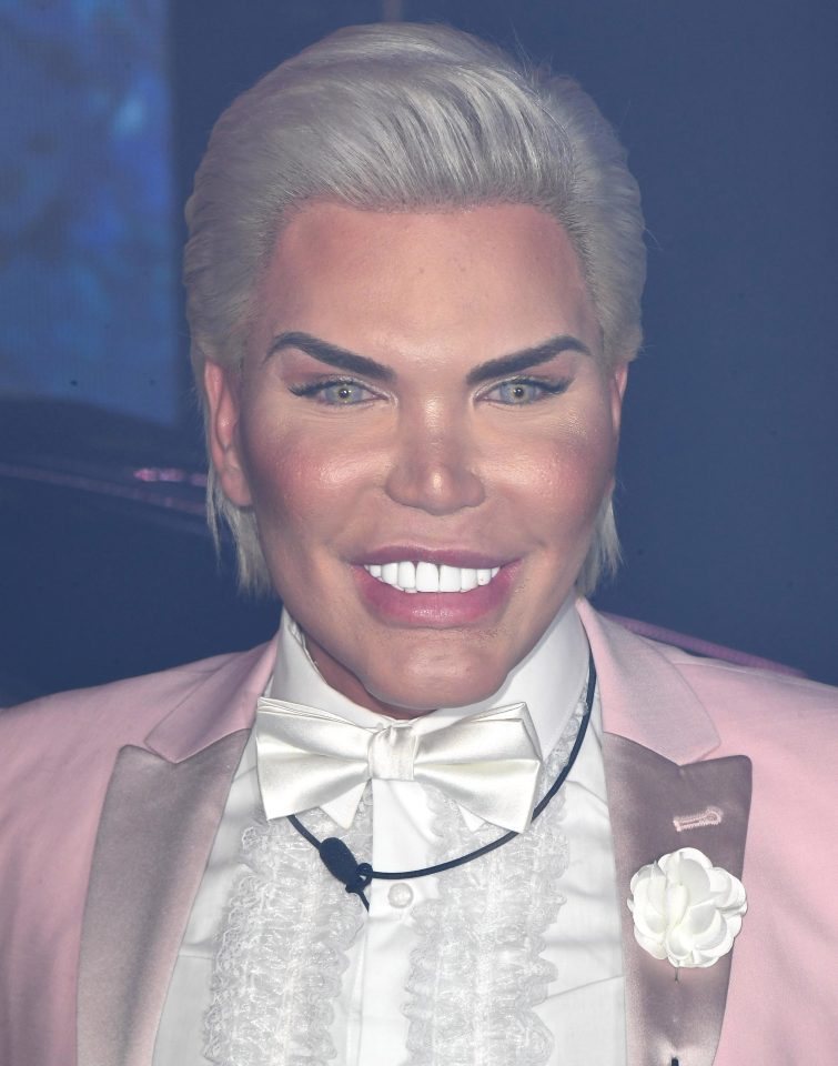  Rodrigo Alves says he needs eye drops in his pocket 'at all times'