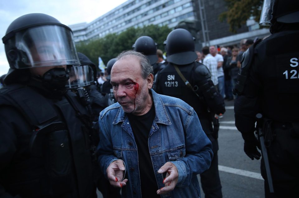  Riot police escort a bleeding right-wing supporter during a confrontation with left groups