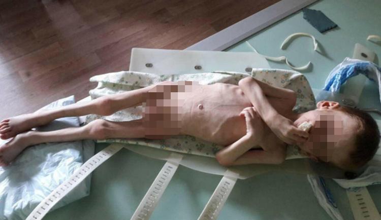  Four-year-old Vladik, above, is pictured lying on a table in a local hospital