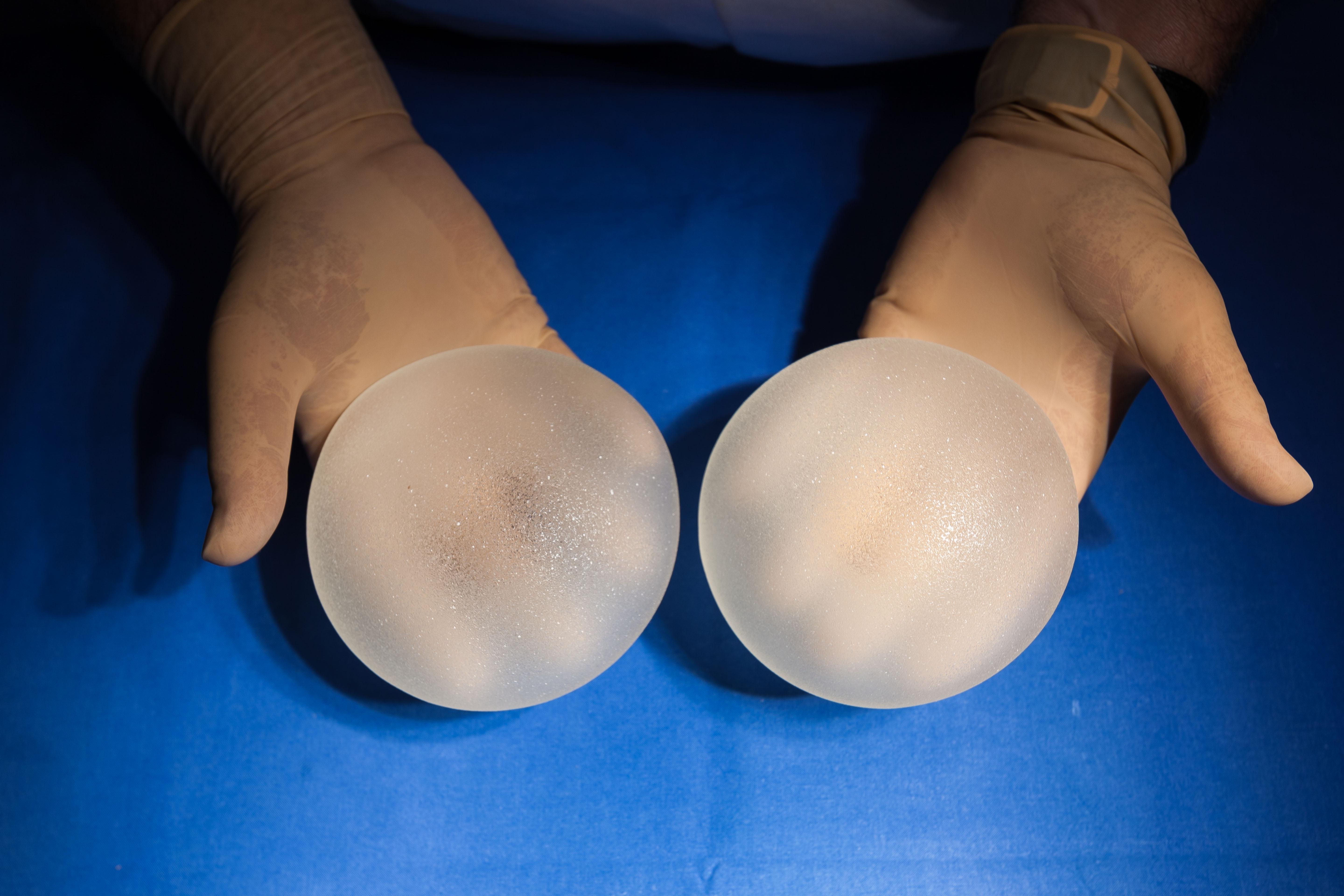 Around 7,000 British women could be forced to pay back compensation for dodgy breast implants amid shocking claims they may never have had boob jobs in the first place