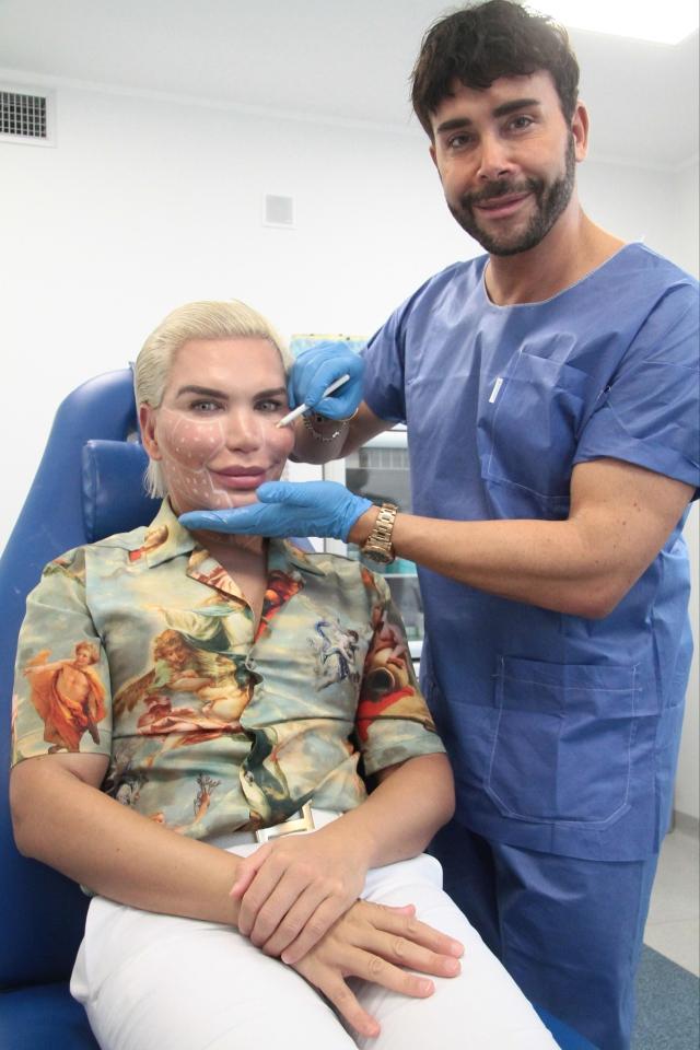  Celebrity Big Brother's Rodrigo has had more plastic surgery done