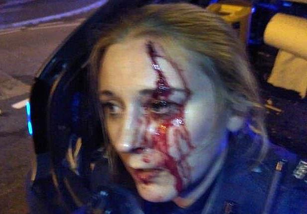  PC Anne Bloomfield suffered a fractured skull and eye socket, as well as cuts and bruises, when Lee Wright hit her in the face with a champagne bottle