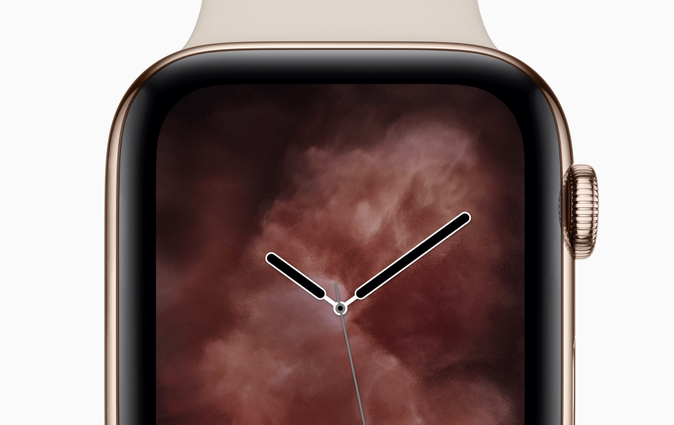  The Apple Watch looks truly stunning – so it's no surprise it's the best-selling watch on the planet