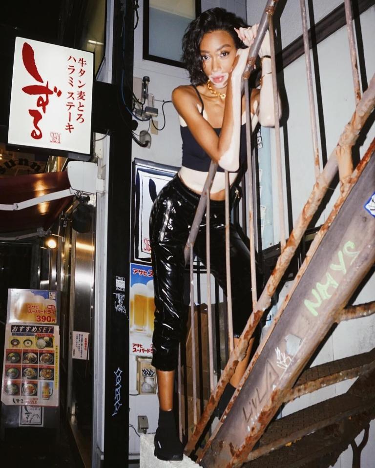  HERE’S model Winnie Harlow taking a step in the right direction as she poses on a staircase in Tokyo, before partying with Lewis Hamilton