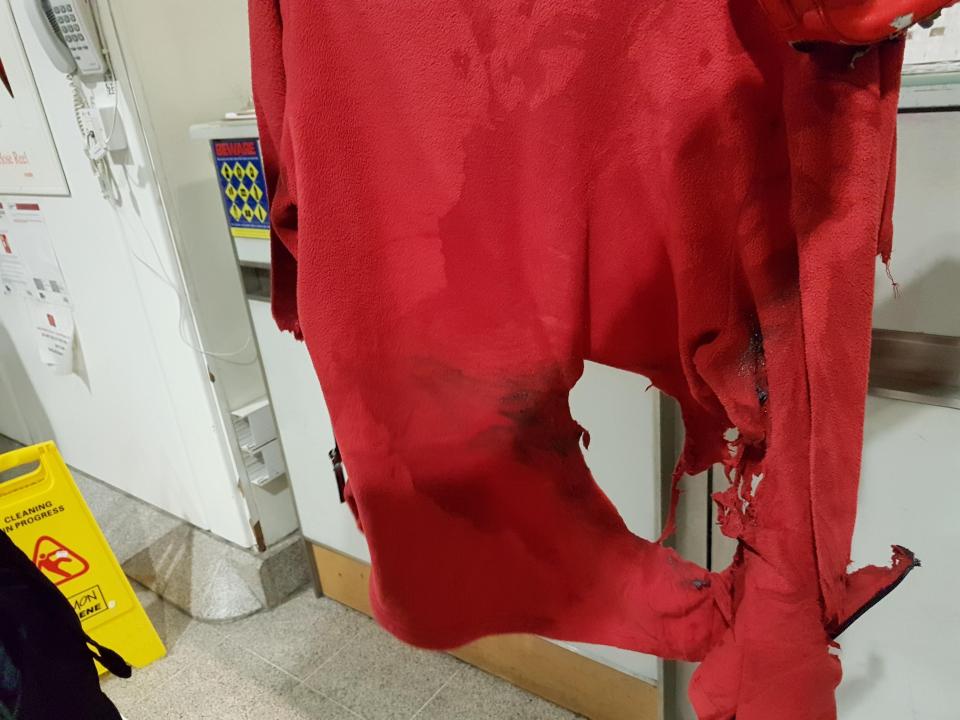  A red fleece was also ruined