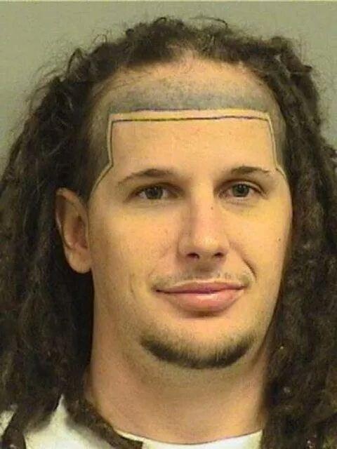  That's one way to deal with a receding hairline