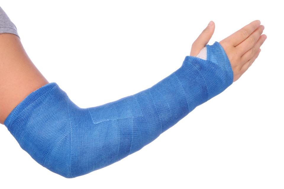  A broken bone can be extremely painful, especially when you try to move the joint